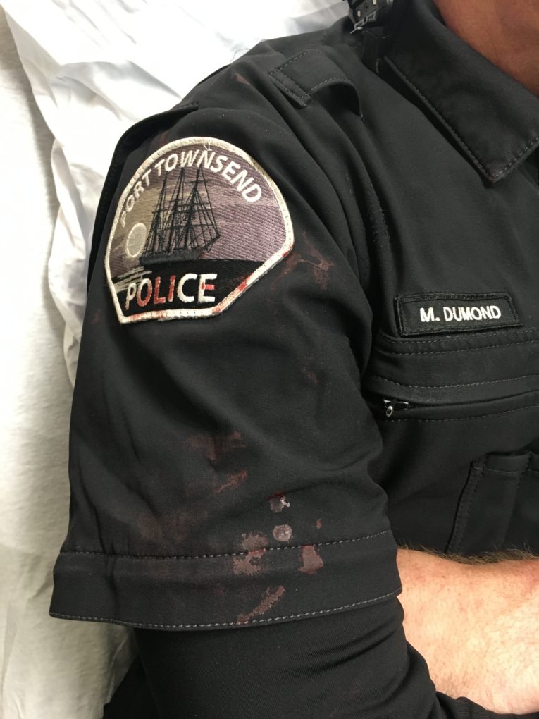 The Violence That Cost Port Townsend A Man Who Saves Lives